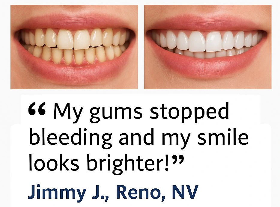 Before and After Smile